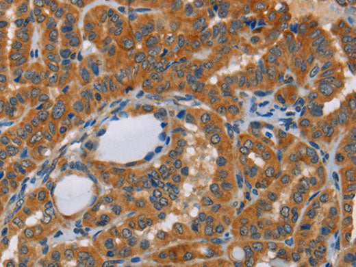 CK-13 Polyclonal Antibody Store at -20°C