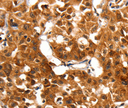 ADAP1 Polyclonal Antibody Store at -20°C