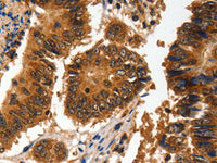 ADAP1 Polyclonal Antibody Store at -20°C