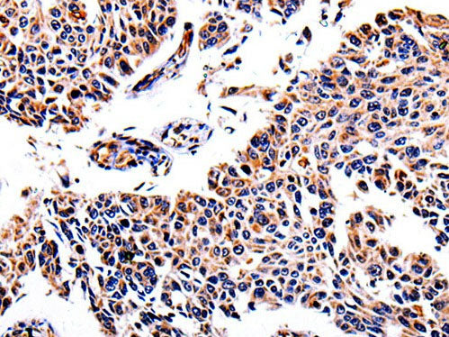 AKR1B1 Polyclonal Antibody Store at -20°C