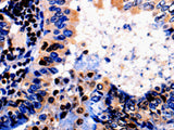 ALOX5 Polyclonal Antibody Store at -20°C