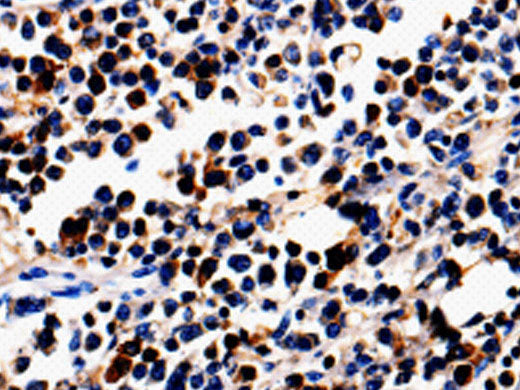 ALOX5 Polyclonal Antibody Store at -20°C
