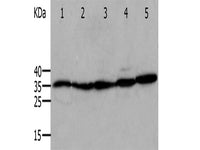 ANXA5 Polyclonal Antibody Store at -20°C