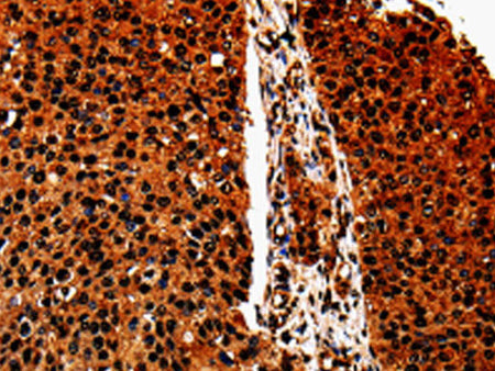 ANXA7 Polyclonal Antibody Store at -20°C