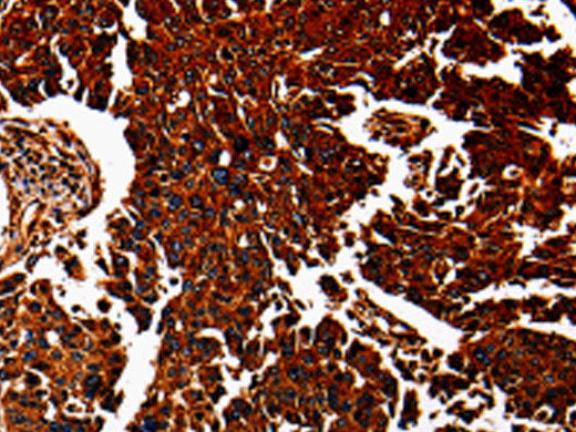 ANXA7 Polyclonal Antibody Store at -20°C