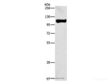 STAT6 Polyclonal Antibody Store at -20°C