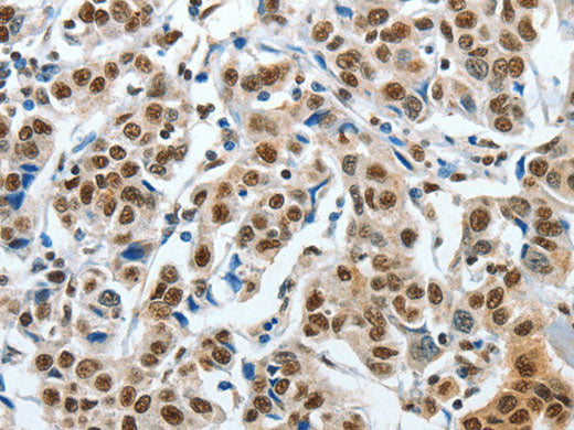 CREB1 Polyclonal Antibody Store at -20°C
