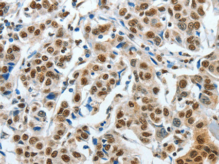 CREB1 Polyclonal Antibody Store at -20°C