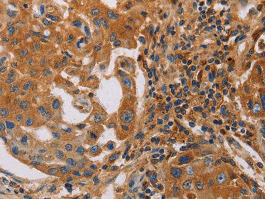 MMP1 Polyclonal Antibody Store at -20°C