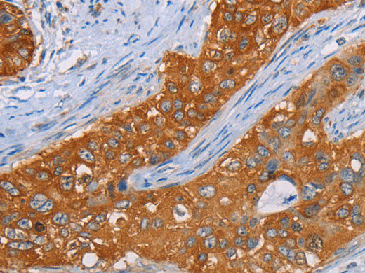 MMP1 Polyclonal Antibody Store at -20°C