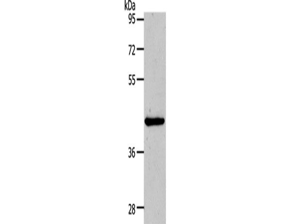 MMP13 Polyclonal Antibody Store at -20°C