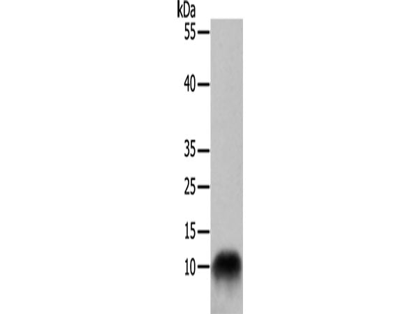 COX7B Polyclonal Antibody Store at -20°C