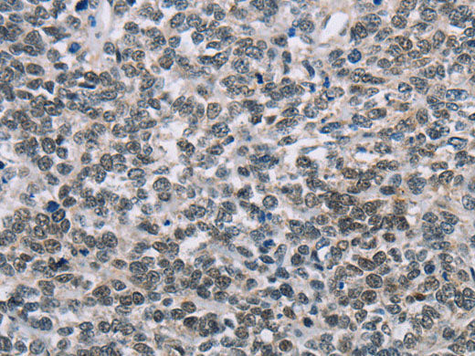 TONSL Polyclonal Antibody Store at -20°C