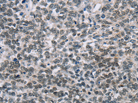 TONSL Polyclonal Antibody Store at -20°C