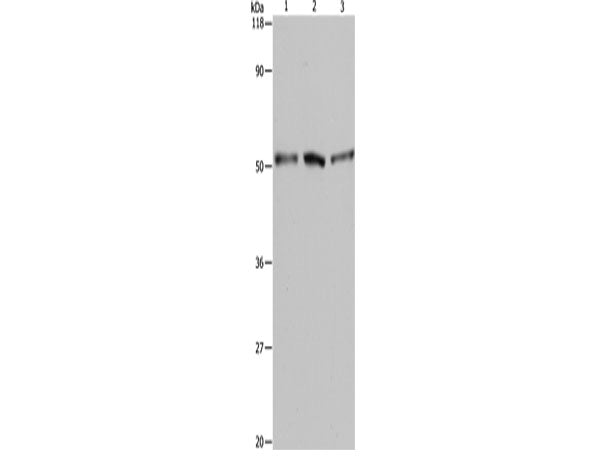 BAG5 Polyclonal Antibody Store at -20°C