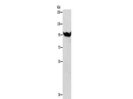 AARS2 Polyclonal Antibody Store at -20°C