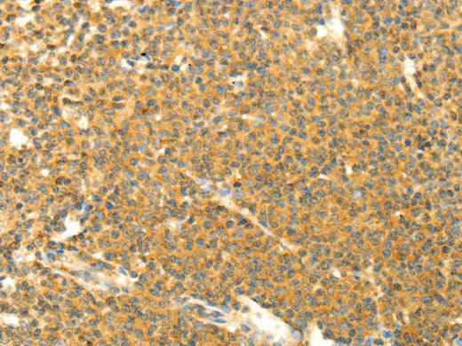 AARS2 Polyclonal Antibody Store at -20°C