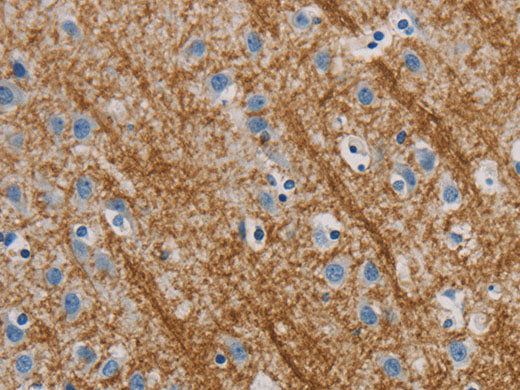 ABL1 Polyclonal Antibody Store at -20°C