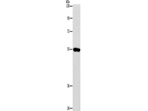 ANGPT2 Polyclonal Antibody Store at -20°C