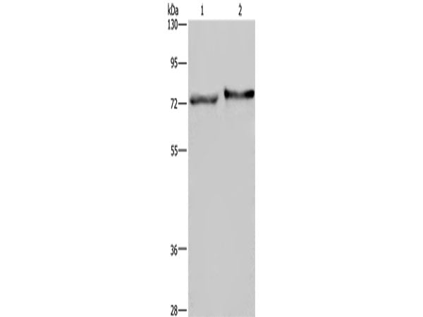 TRIM29 Polyclonal Antibody Store at -20°C
