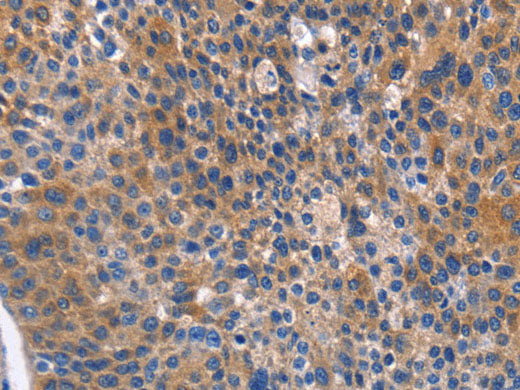 ARRB1 Polyclonal Antibody Store at -20°C