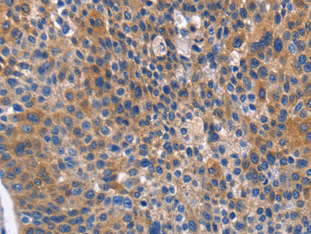 ARRB1 Polyclonal Antibody Store at -20°C