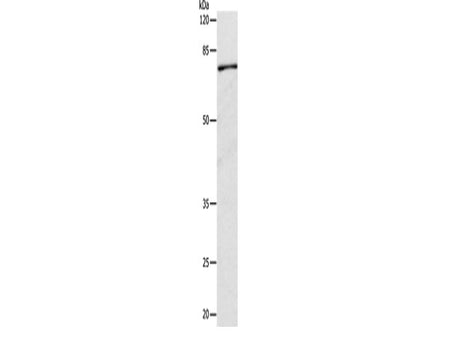 CAPN1 Polyclonal Antibody Store at -20°C