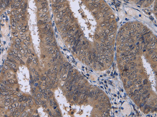 CDK5 Polyclonal Antibody Store at -20°C
