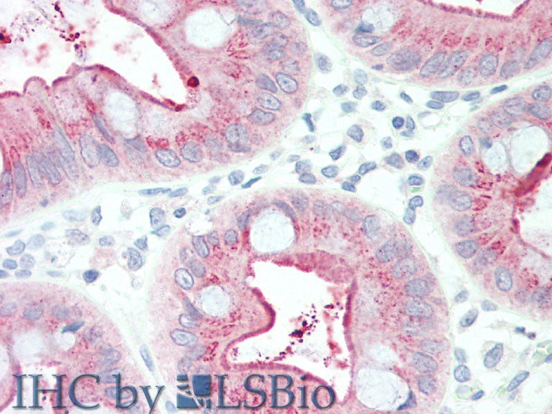 CEACAM8 Polyclonal Antibody Store at -20°C