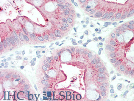 CEACAM8 Polyclonal Antibody Store at -20°C