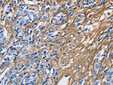 COL3A1 Polyclonal Antibody Store at -20°C