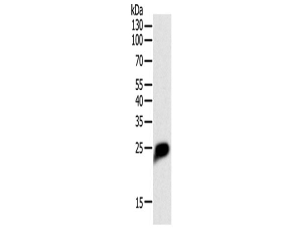 CRP Polyclonal Antibody Store at -20°C