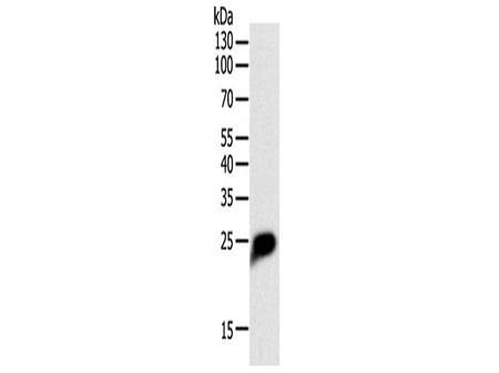 CRP Polyclonal Antibody Store at -20°C