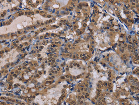 CUL3 Polyclonal Antibody Store at -20°C