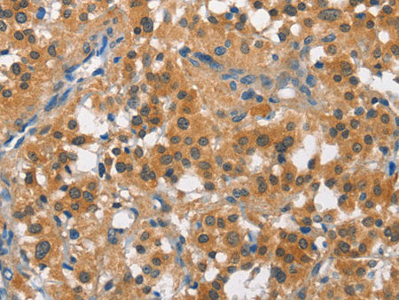 CUL7 Polyclonal Antibody