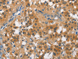 CUL7 Polyclonal Antibody