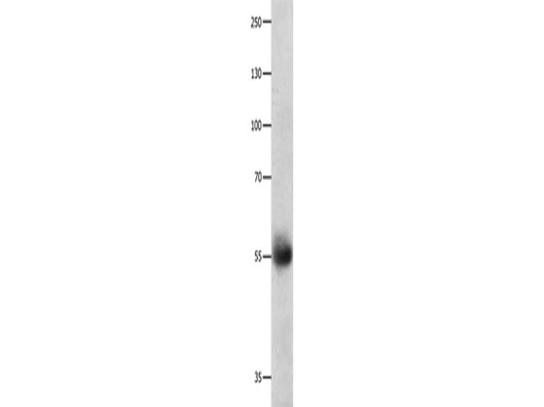 DRD5 Polyclonal Antibody Store at -20°C
