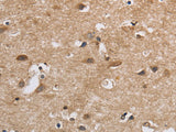 SDCCAG3 Polyclonal Antibody