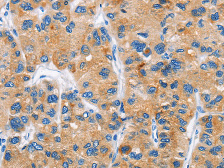 DKK2 Polyclonal Antibody Store at -20°C
