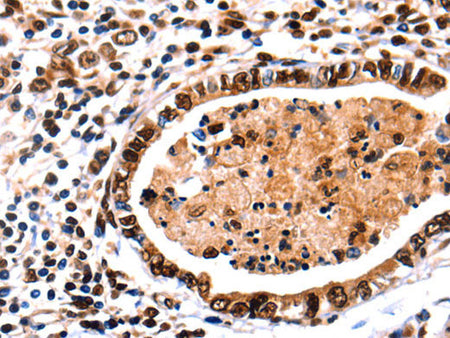 DNMT3A Polyclonal Antibody Store at -20°C