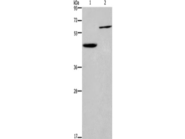 DOK1 Polyclonal Antibody Store at -20°C