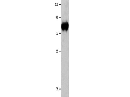 ECE1 Polyclonal Antibody Store at -20°C