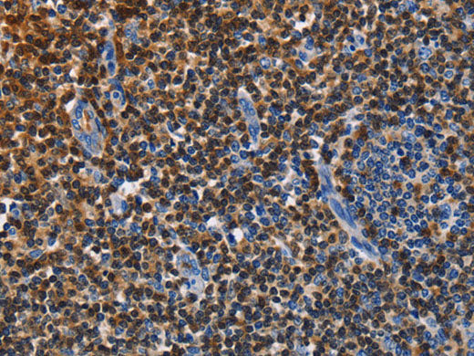 ENPP5 Polyclonal Antibody Store at -20°C