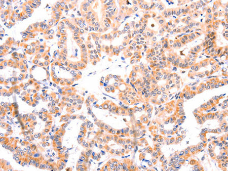 Ephrin A1 Polyclonal Antibody Store at -20°C
