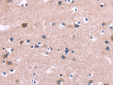 DUSP13 Polyclonal Antibody Store at -20°C