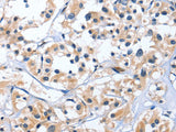 EDN3 Polyclonal Antibody Store at -20°C
