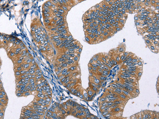 EDN2 Polyclonal Antibody Store at -20°C