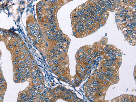 EDN2 Polyclonal Antibody Store at -20°C