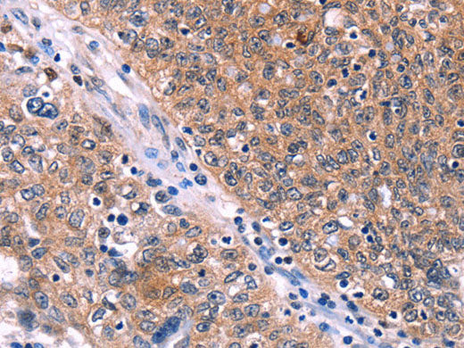 EDN1 Polyclonal Antibody Store at -20°C