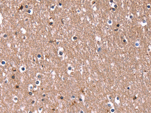 RDX Polyclonal Antibody Store at -20°C